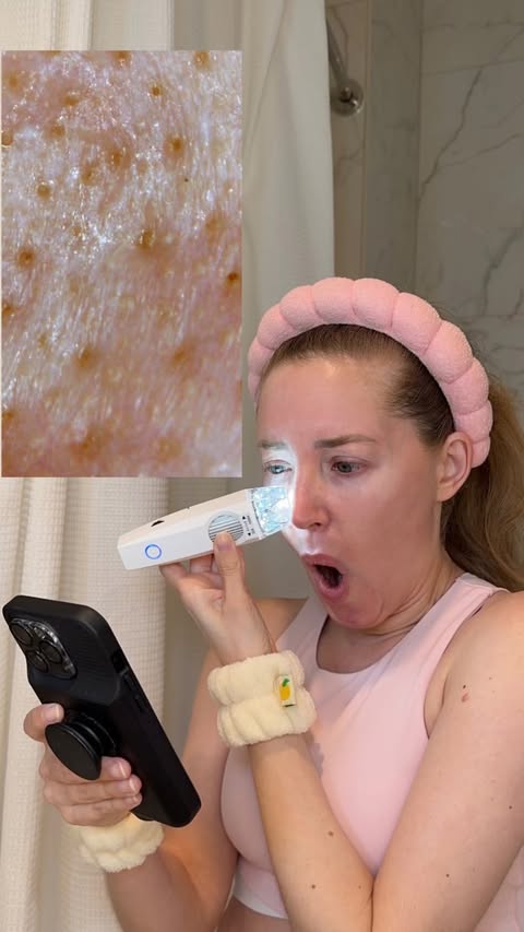 Instagram post by @jillian.gottlieb for ilso. Caption reads: [...] for how to make pores look better FAST....