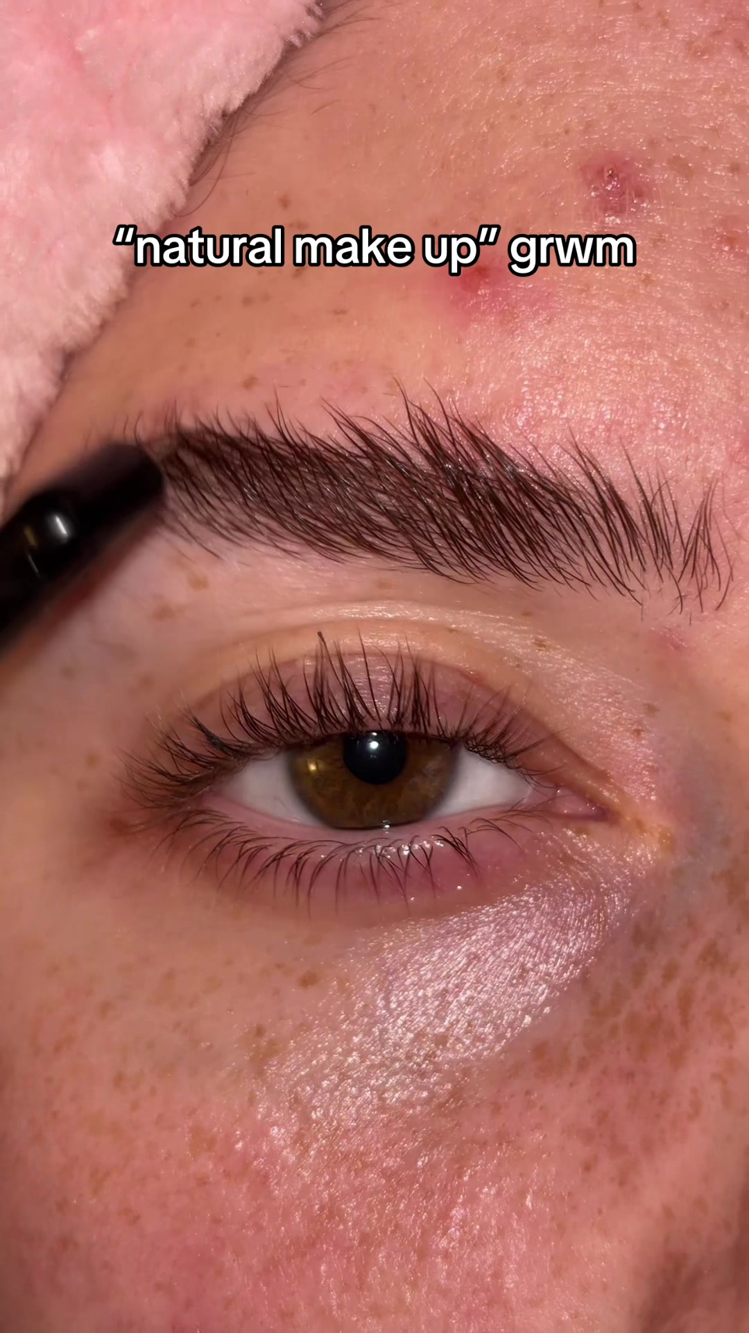 TikTok post by @shopping_addiction12 for Nature Spell. Caption reads: desperately need some pimple patches too😖 #fyp....