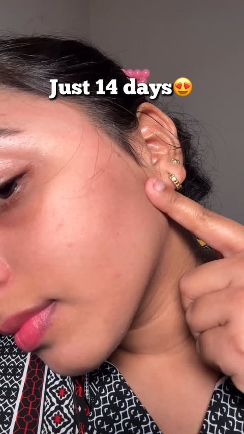 Instagram post by @journey_with_sweta_ for Foxtale. Caption reads: Comment for link ✨🤌🏻 [Foxtale’s 12% Niacinamide....