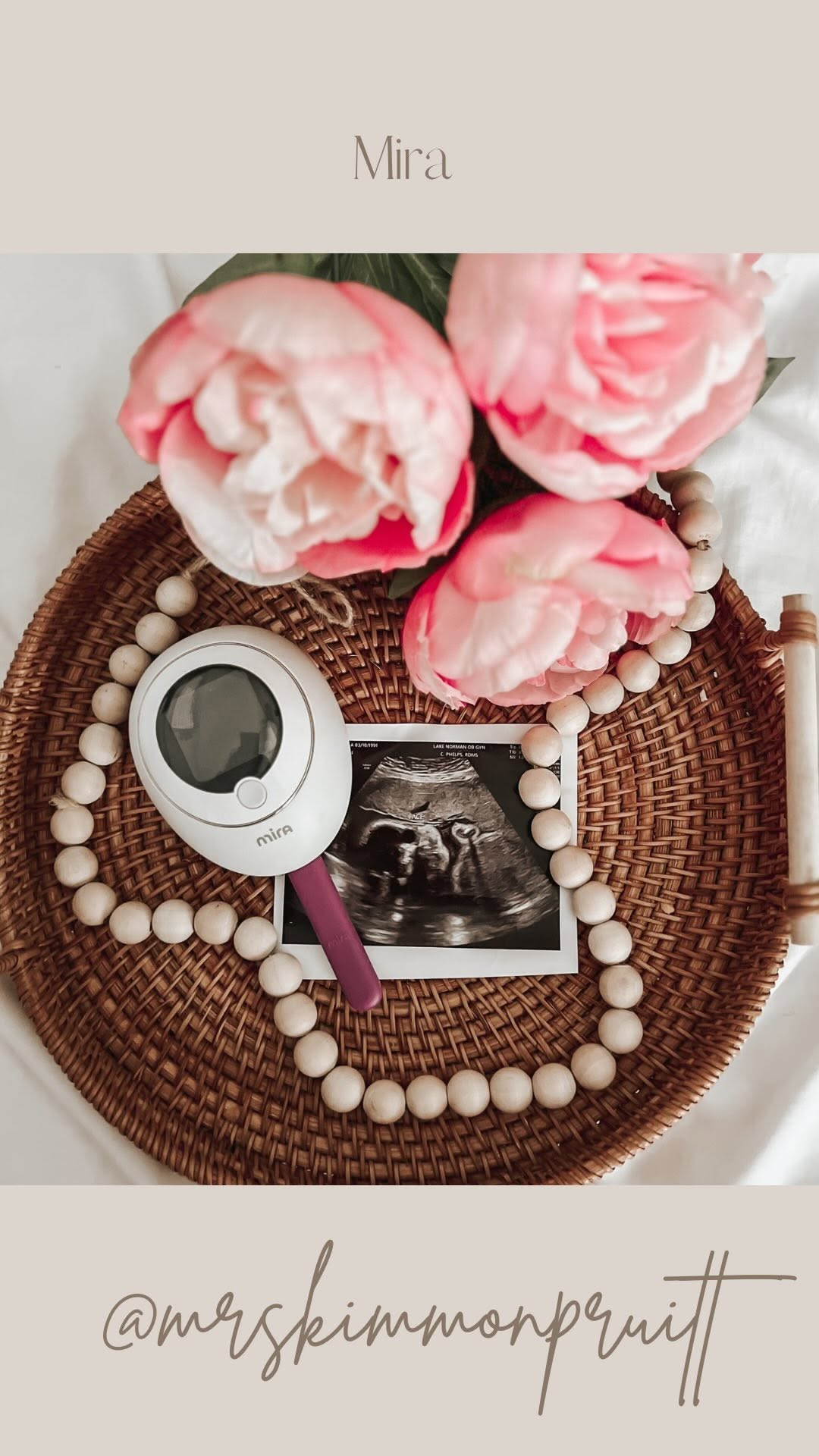 Instagram post by @purelypruitts for Mira Fertility. Caption reads: To conceive the first time took us over 2.5 years.....