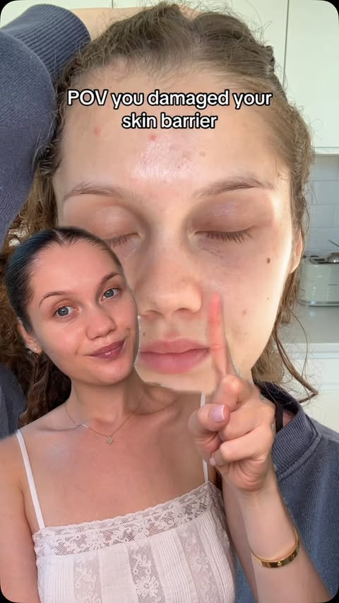 Instagram post by @sparklesandskin for Centellian24. Caption reads: POV you damaged your skin barrier @centellian24....