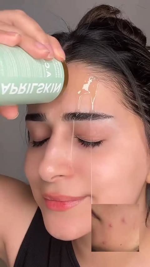 Instagram post by @kawthar_zahid for APRILSKIN. Caption reads: @aprilskin_global #aprilskin #acne #damagedskin....