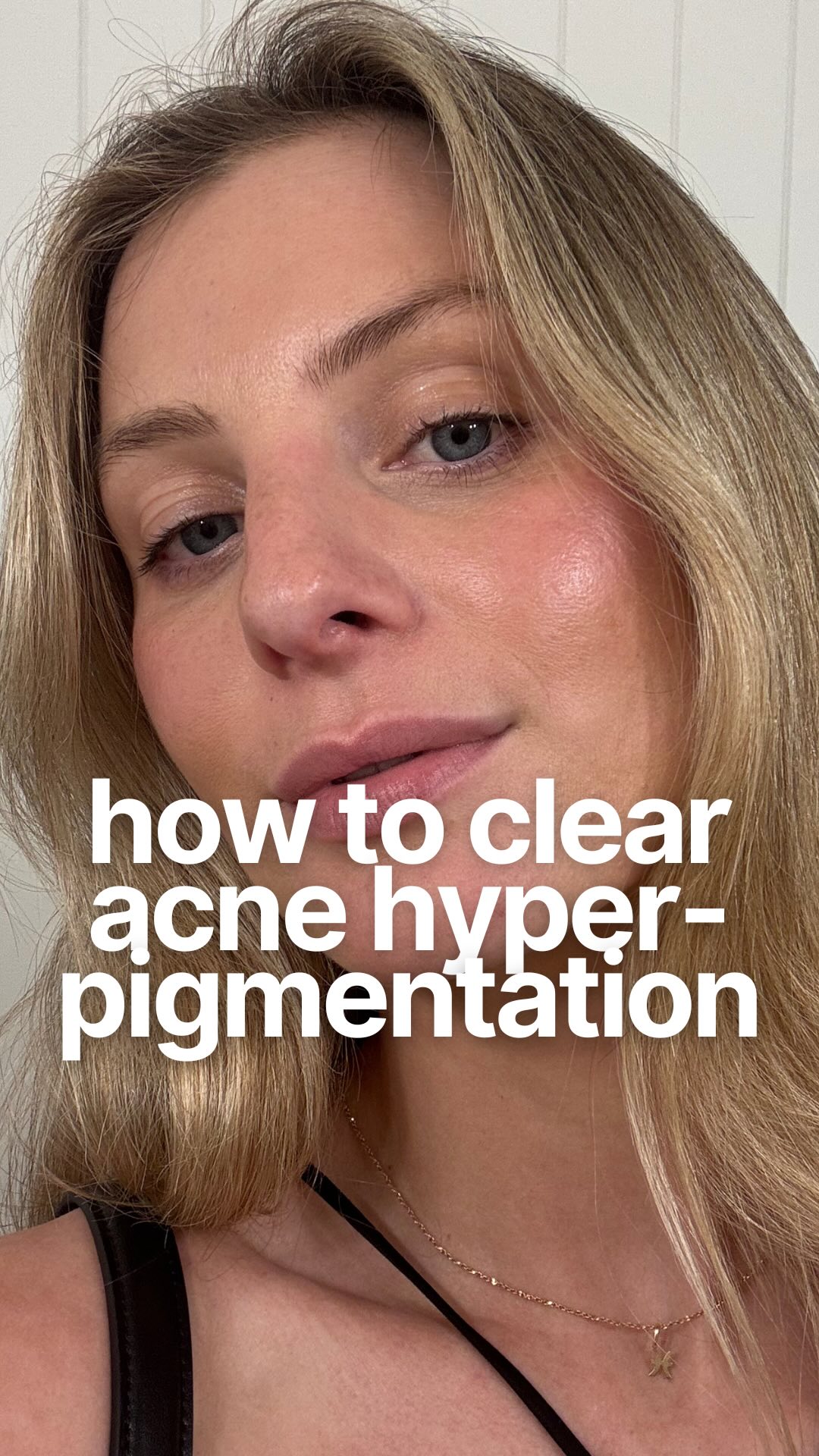 Instagram post by @theacnenutritionist for Amperna. Caption reads: [...] the full skincare protocol I’m using.....