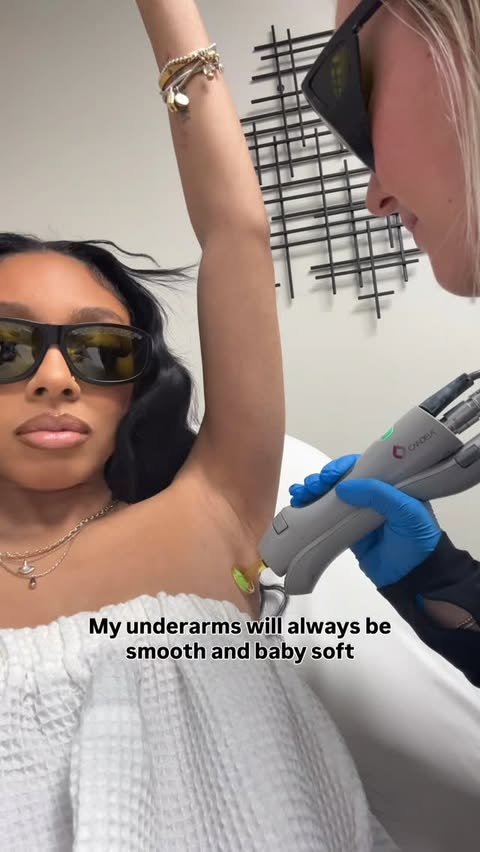Instagram post by @glambysydb for Milan Laser Hair Removal. Caption reads: my 1st laser hair removal session with @milanlaser....
