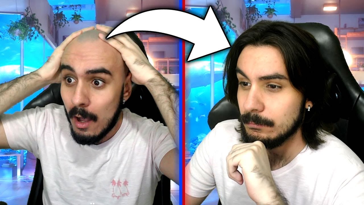 YouTube post by @Fir3z for CSGO-SKINS.COM. Caption reads: Fir3z is no longer BALD!!!!!! 🤣🤣🤣 [reupload].