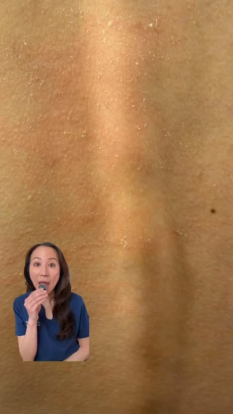 Instagram post by @derm.talk for Ivory Soap. Caption reads: #ad #IvoryPartner Your sensitive skin deserves....