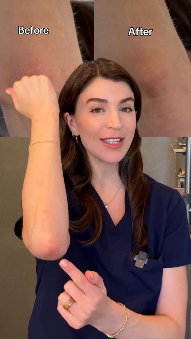 Instagram post by @drkatiebeleznay for Suave. Caption reads: [...] crusty elbows and knees? Not anymore. Thanks....