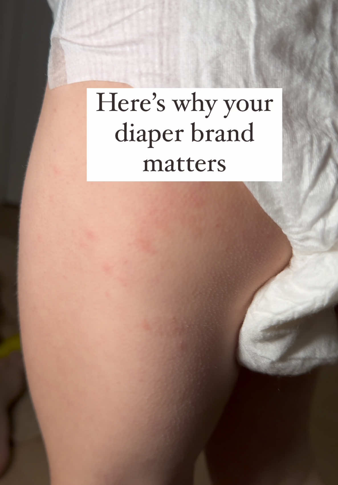 TikTok post by @christieferrari for DYPER. Caption reads: [...] rashes so we tried switching to DYPER -....