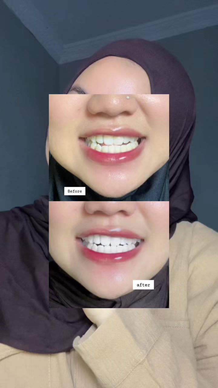 TikTok post by @cicihariss for Metoo Beauty. Caption reads: [...] ya loo weii pdhl cuman pake ini😭 @Metoo....