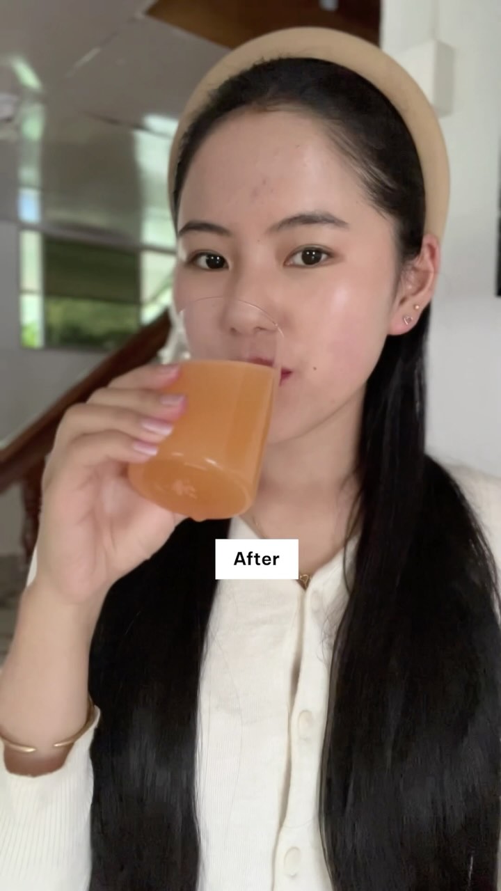 Instagram post by @palmuu_ for HK Vitals. Caption reads: Struggled with skin issues — until I decided to....