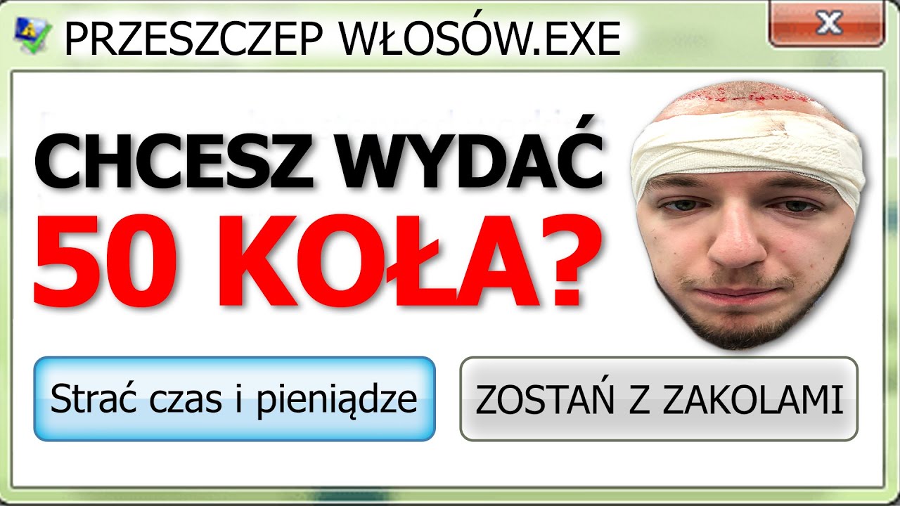 YouTube post by @Gimper for Diablo Chairs. Caption reads: zagrałem w gry o przeszczepie moich włosów.