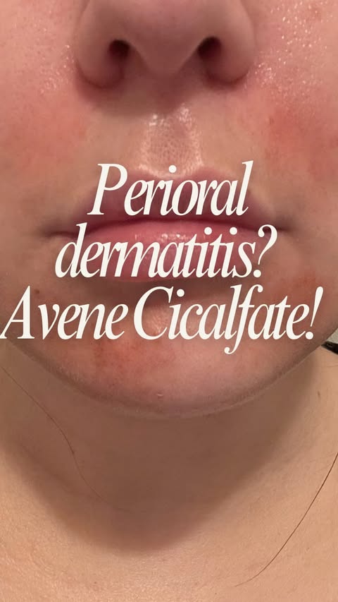 Instagram post by @skin_vestmentt for Avène. Caption reads: Paid partnership with Avène 🤍 I have spent years....