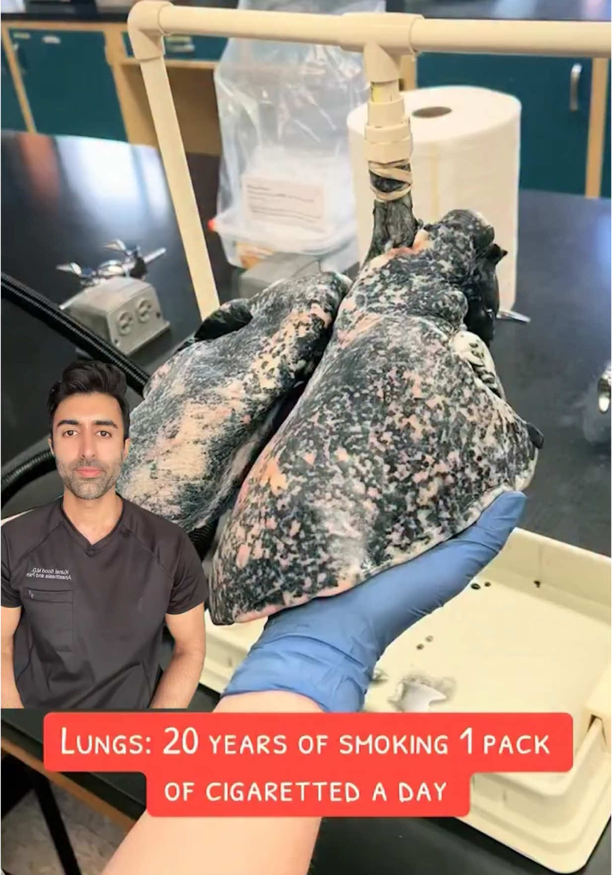 TikTok post by @doctorsood for Resbiotic. Caption reads: Over time, smoking can increase the risk of lung....