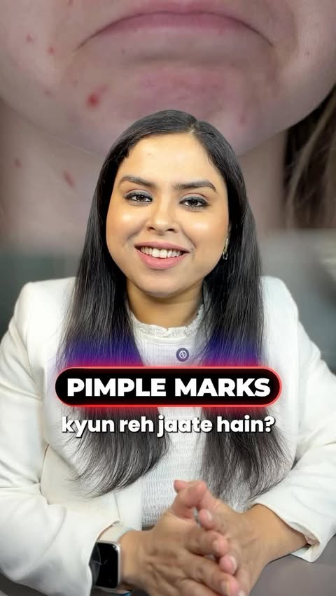 Instagram post by @dermisskinclinic for Himalaya Face Care. Caption reads: Pimples may heal fast… but post-inflammatory marks....