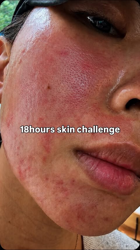 Instagram post by @skincare.zombie for HEVEBLUE. Caption reads: [...] challenge accepted👀 Product uses : Heveblue....