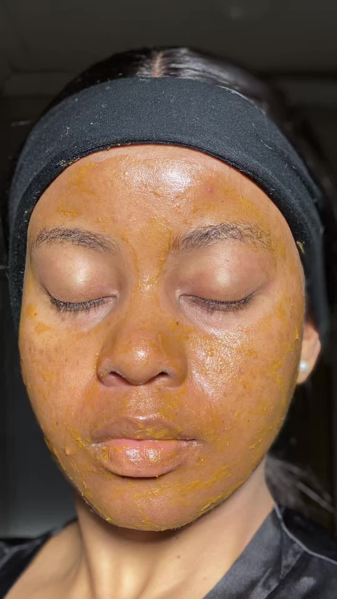 TikTok post by @simphiwee_mb for Banish. Caption reads: Hey Beautiful ❤️ I didn’t expect dealing with dark....