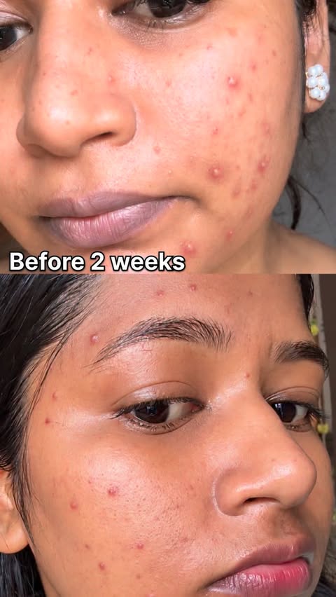 Instagram post by an influencer for The Derma Co. Caption reads: [...] “FACEWASH” for link 🔗 @thedermacoindia.