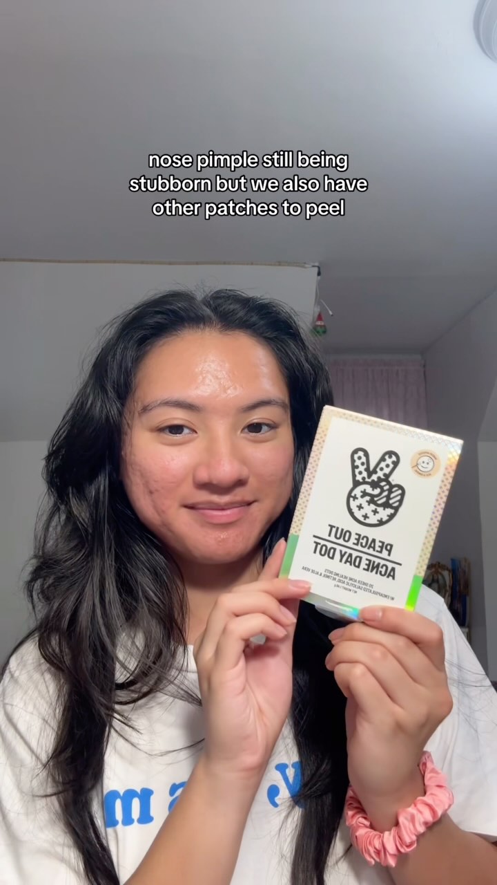 Instagram post by @thatacnegirlie for Peace Out Skincare. Caption reads: at least the nose pimple doesn’t hurt anymore?....