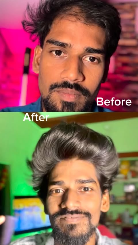 Instagram post by @mittai_film_maker for Bare Anatomy. Caption reads: Try to 10days results #BareAnatomy....