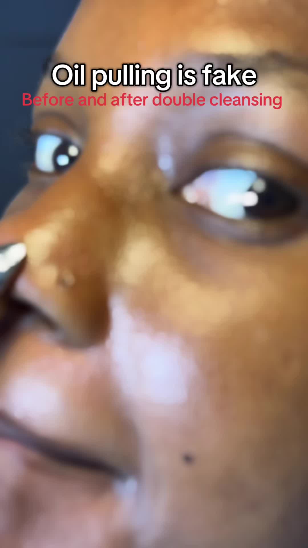 TikTok post by @__rubyskin1 for Medicube. Caption reads: [...] filaments in 5mins I’m impressed  @medicube....