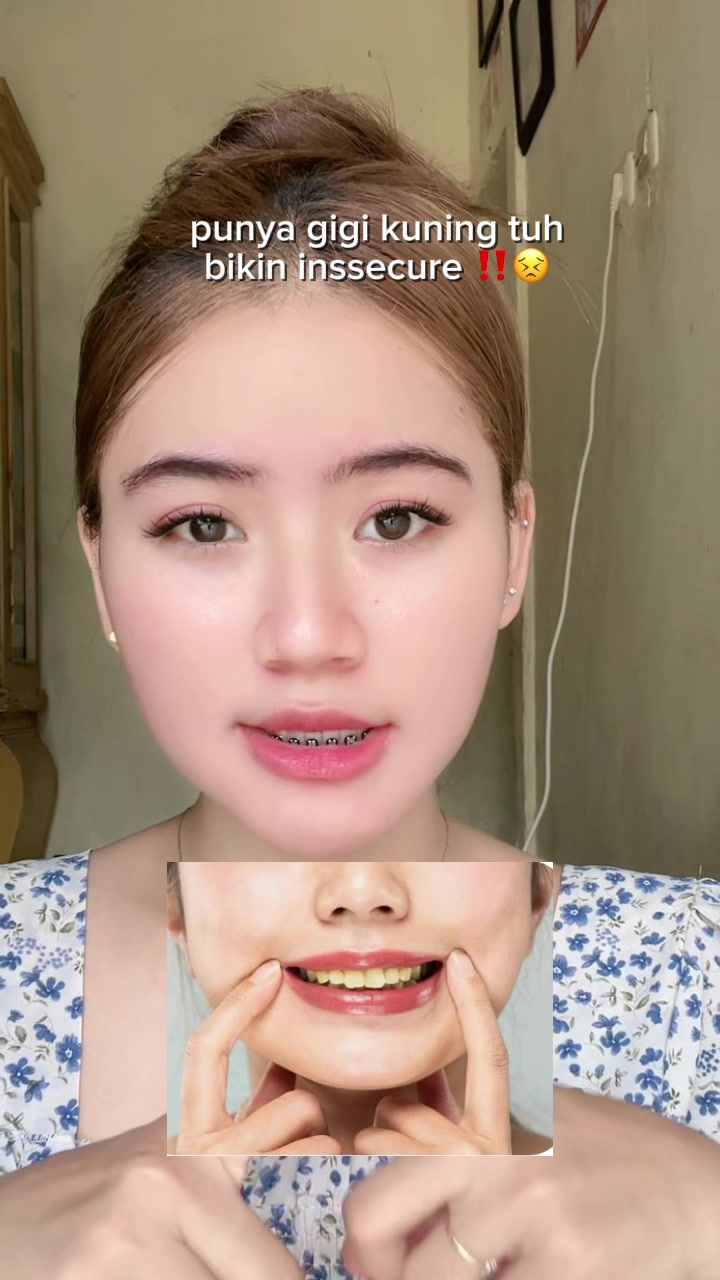 TikTok post by @fracyla_ for Metoo Beauty. Caption reads: [...] rutin sikat gigi pake metto mw-3 🤍@Metoo....
