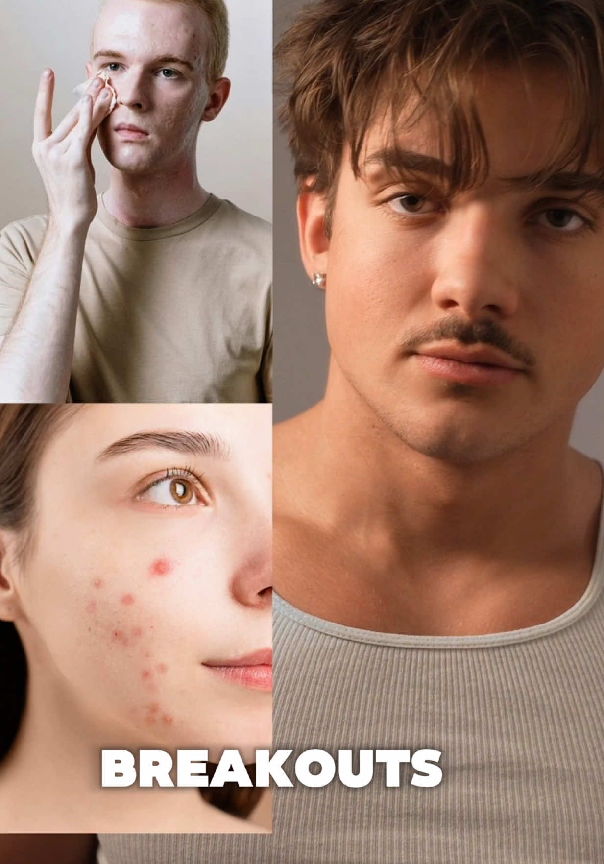 TikTok post by @elijah_forcier for APRILSKIN. Caption reads: stop popping your acne do this! #skincare....