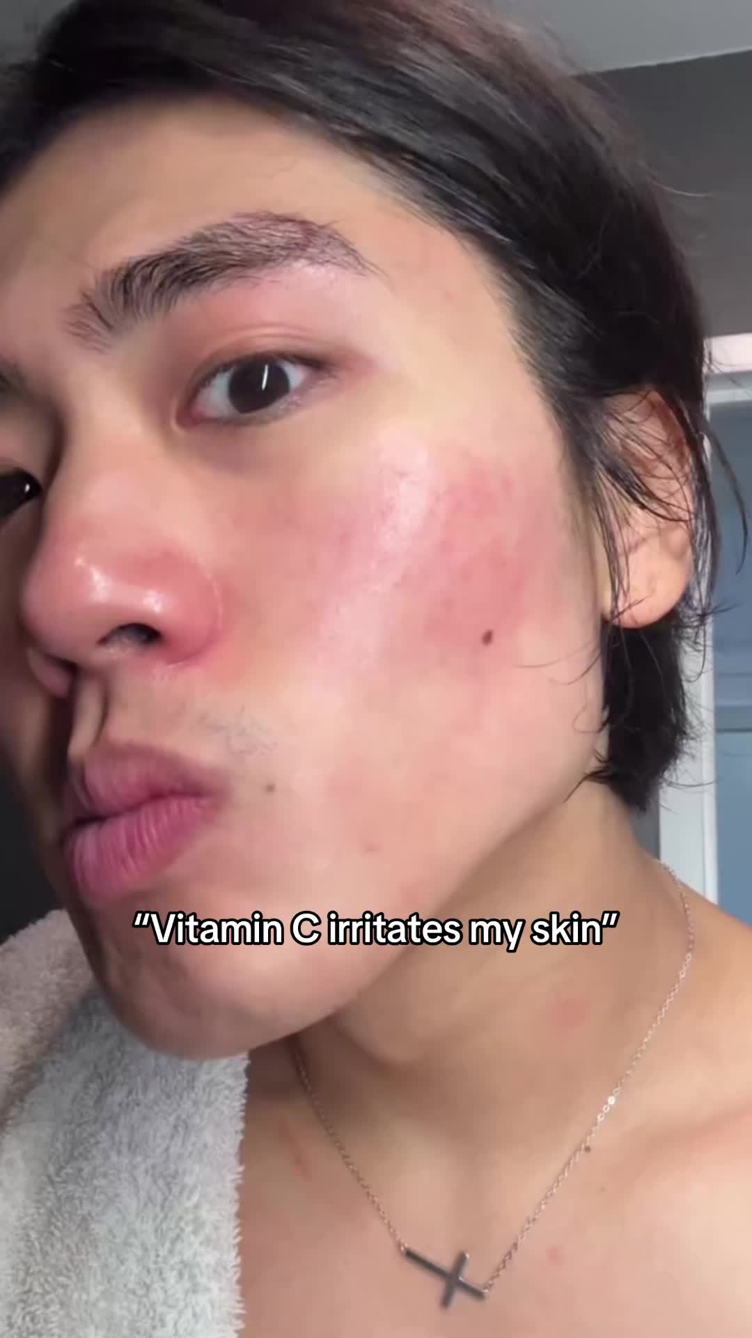 TikTok post by @hwaniiee for Bloomkare. Caption reads: [...] #hyperpigmentation #darkspots @Bloomkare....