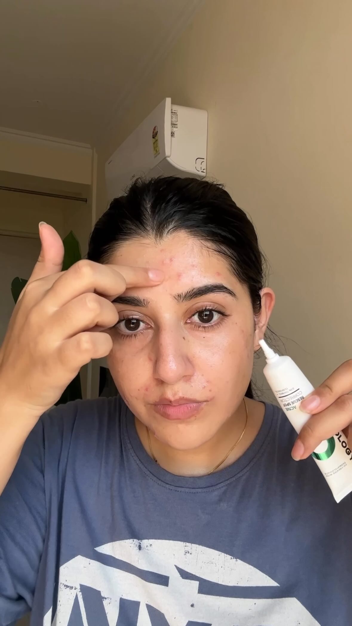 Instagram post by @swati_chauhan_ for Novology. Caption reads: Remember my bad skin phase? yeah… skin has been....