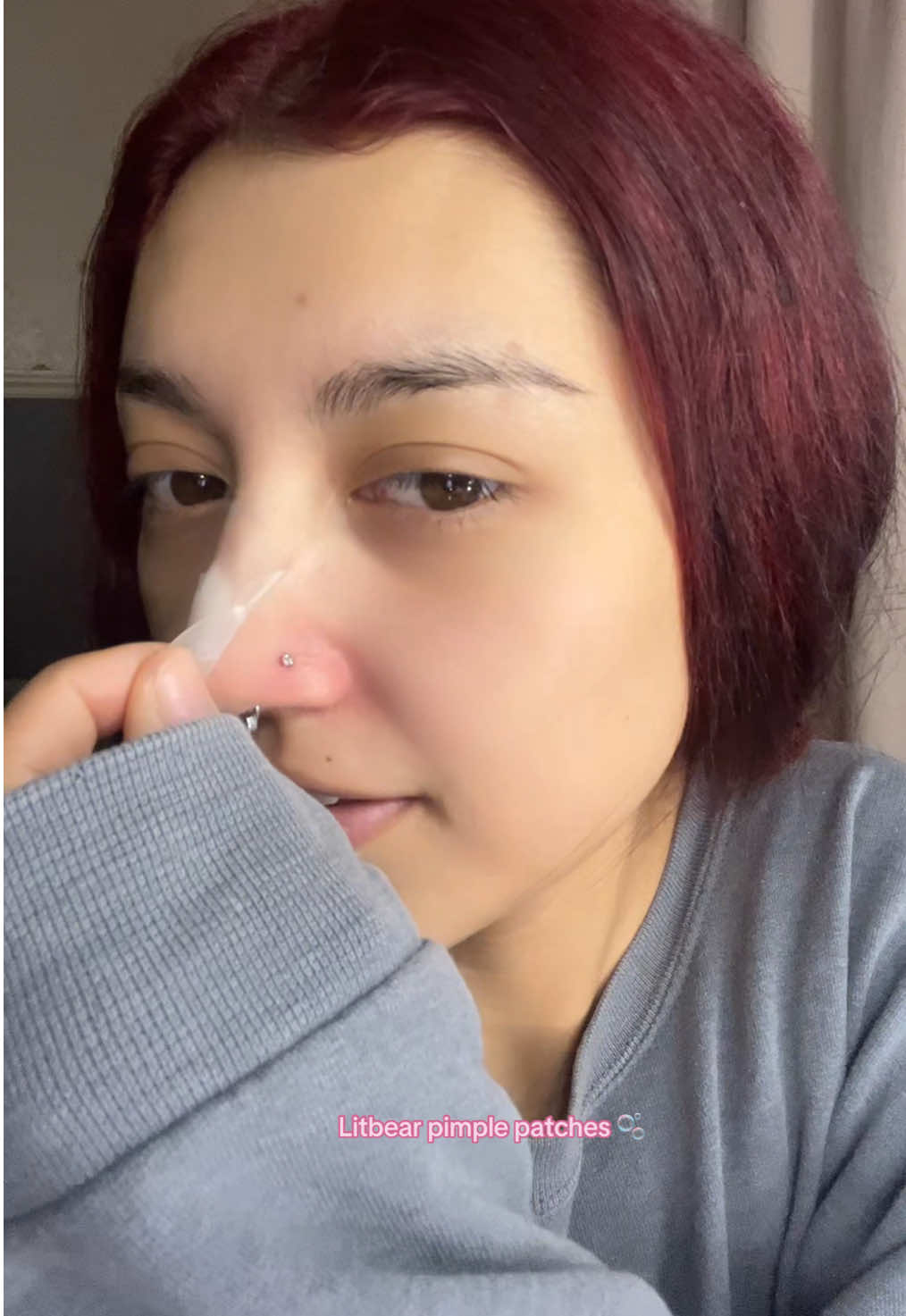 TikTok post by @sadgrungeee for LitBear. Caption reads: @LitBear 🤍 #fyp #foryoupage #pimplepatch [...].