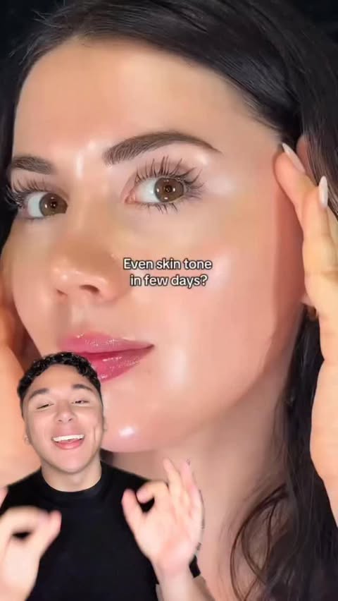 Instagram post by @carlos_cervante for Easydew. Caption reads: [...] #darkspots #hyperpigmentation #fyp....