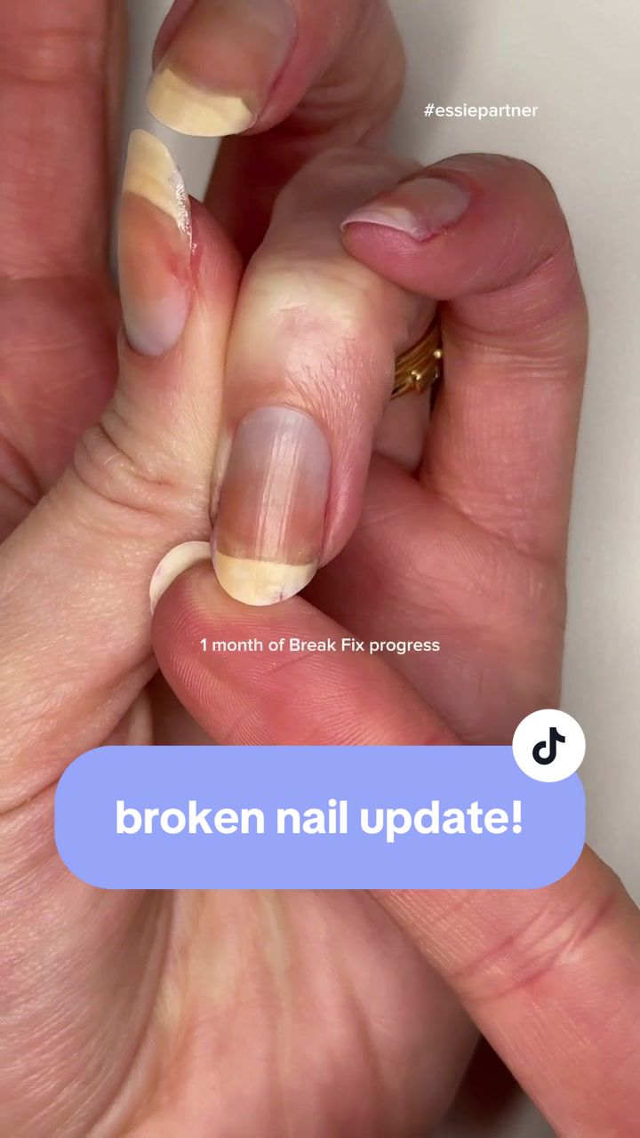 TikTok post by @allyrooker for essie. Caption reads: I tested out @essie Break Fix Liquid Nail Patch on....