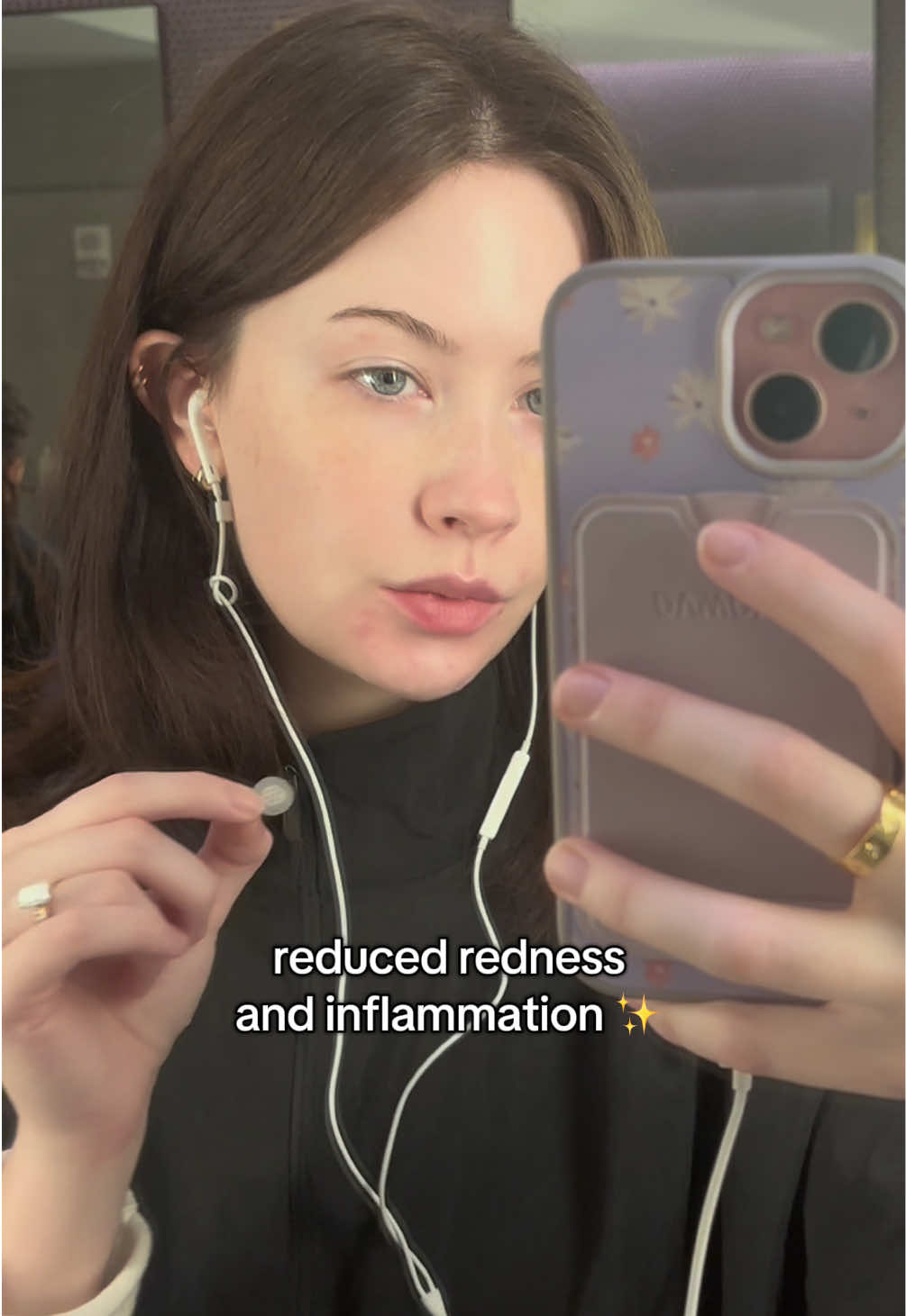 TikTok post by @kaydlim for Easyderm Vietnam. Caption reads: my favorite pimple patch for traveling!! always....