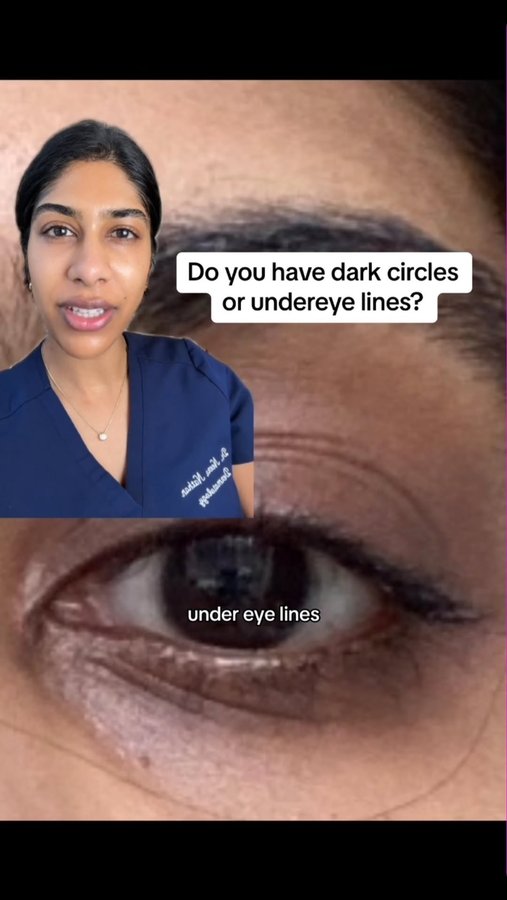 Instagram post by @dermatologysurgeon for Andalou Naturals. Caption reads: Dark circles or crow’s feet? @andalounaturals....