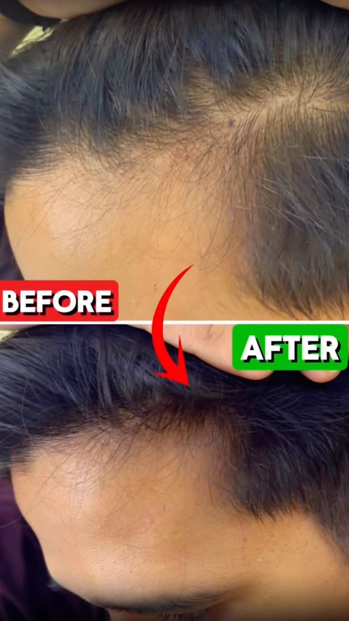 Instagram post by @satyamrao04 for Indulekha. Caption reads: Comment “2” for the Link ✅

⚠️ Agar weak, patle....