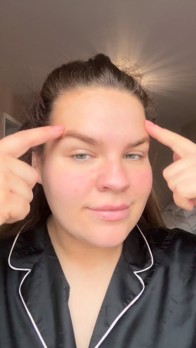 Instagram post by @emmakearney99 for Dermatica. Caption reads: AD/ Skin update 💧 People I have been using....