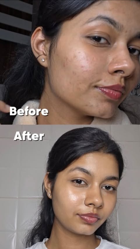 Instagram post by @glowwithradhu for Novology. Caption reads: Tried the Novology Acne Deep Clearing Cleanser and....