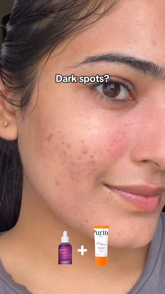 Instagram post by @skinn.saviour for OLIVE YOUNG. Caption reads: Hypersensitive skin? Dark spots?
Large pores?Acne....