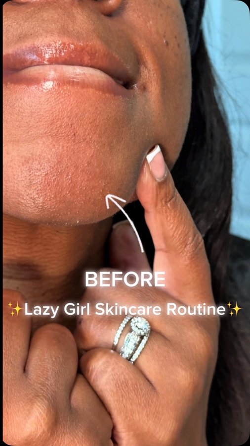 Instagram post by @shondastyleofficial for Buttah Skin. Caption reads: [...] my skin fresh and blackheads at bay.....