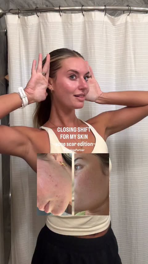 Instagram post by @goesbymeg for Curology. Caption reads: #CurologyPartner real results don’t have to be....