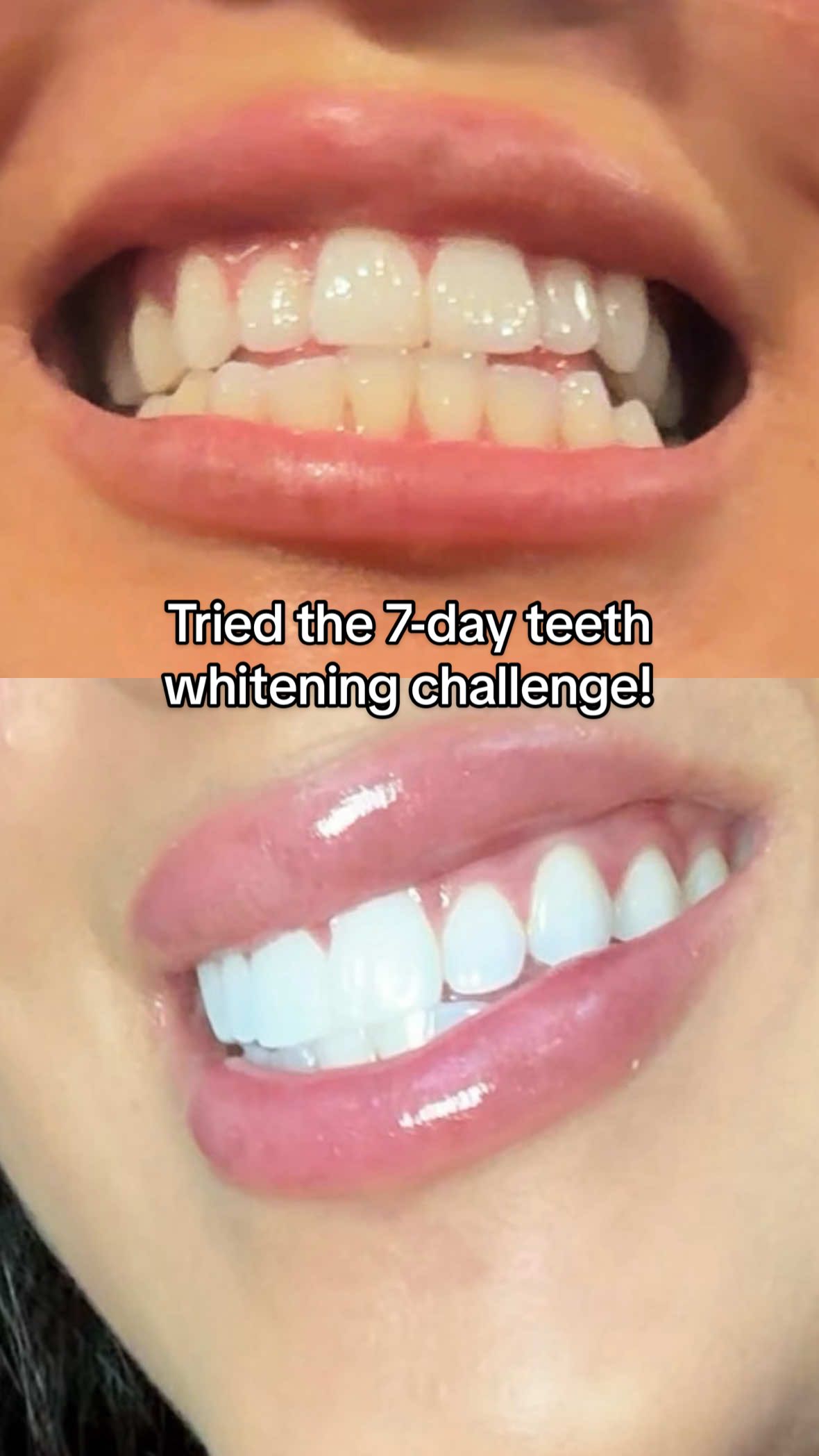 TikTok post by @jennybabascomedy for PurelyWHITE DELUXE. Caption reads: Love how gentle this is on my teeth! ....