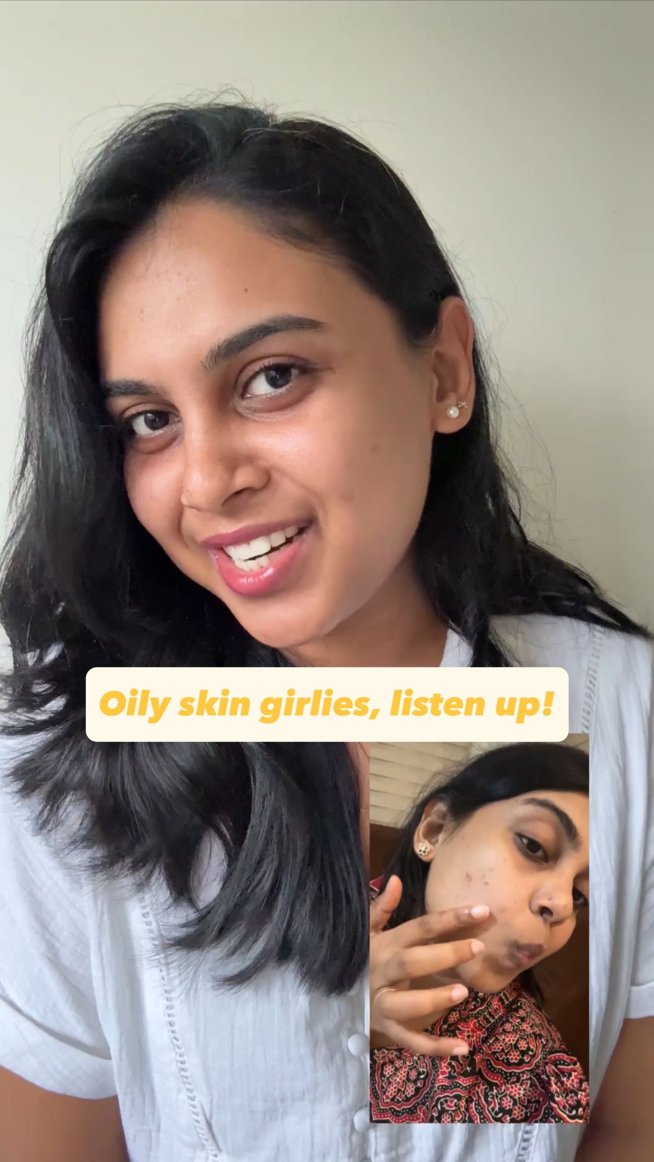 Instagram post by @alka_dickson for Foxtale. Caption reads: 🛑STOP scrolling!! If you have oily skin! 🛑 I....