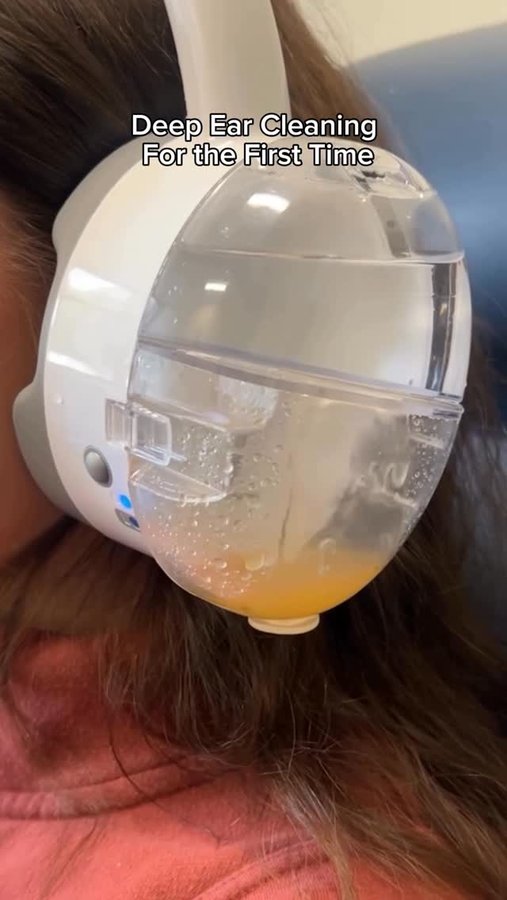 Instagram post by @bigfoodie101 for OtoSet. Caption reads: Have you tried deep ear cleaning?.