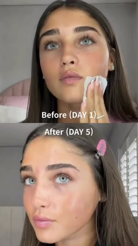 Instagram post by @siennawalker__ for Mediheal. Caption reads: [...] used the Madecassoside toner pads from....