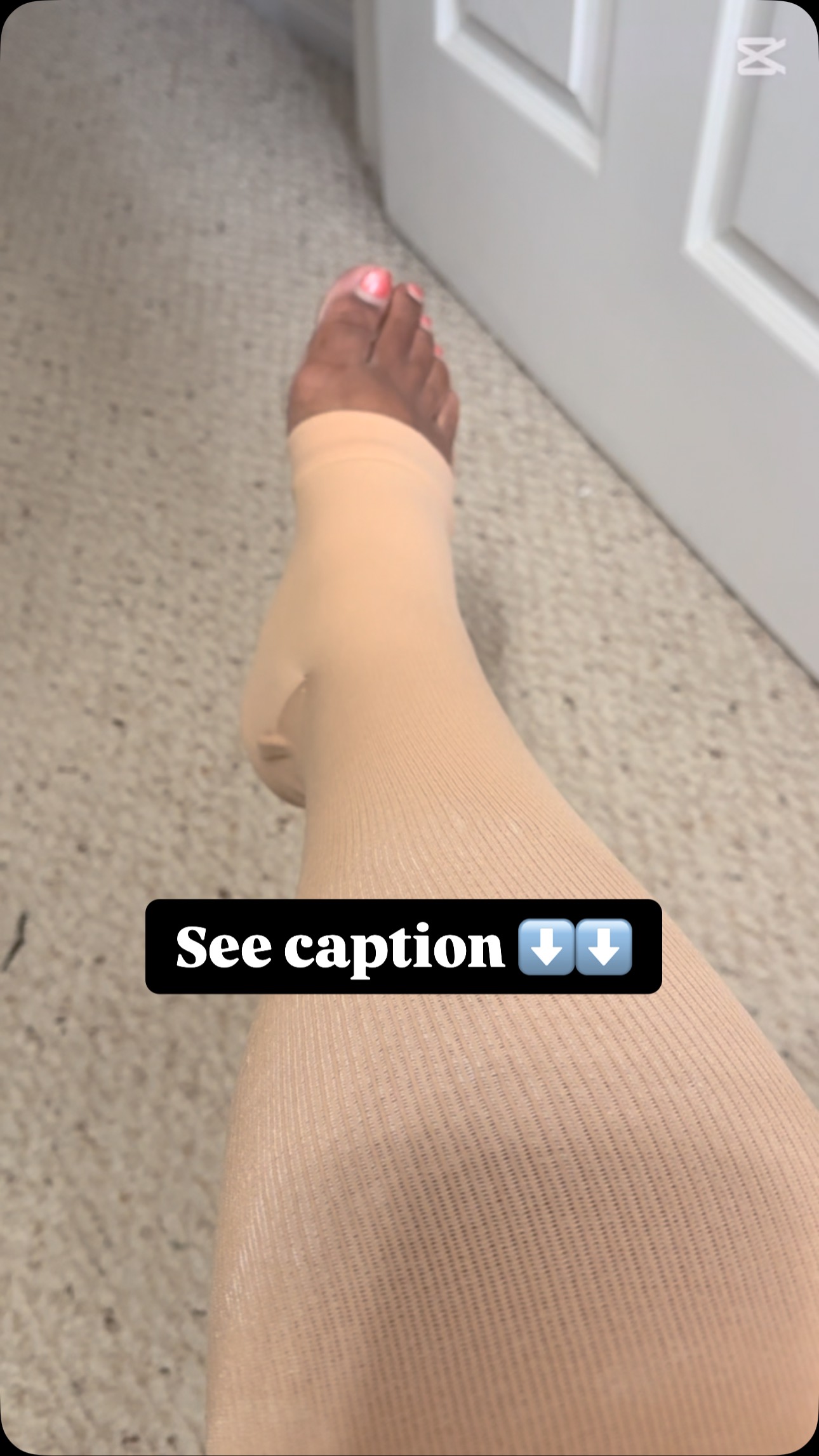 Instagram post by @menohealthnurse for Plusock. Caption reads: [...] tried my new compression stockings from....