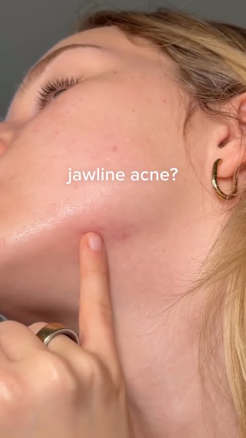 Instagram post by @lifewithmils_ for Anua. Caption reads: The BEST skincare for every problem!⭐️⬇️

ad....