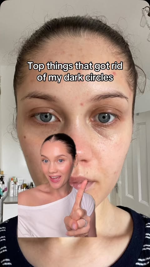 Instagram post by @sparklesandskin for Centellian24. Caption reads: [...] of my dark circles! I’m using the....