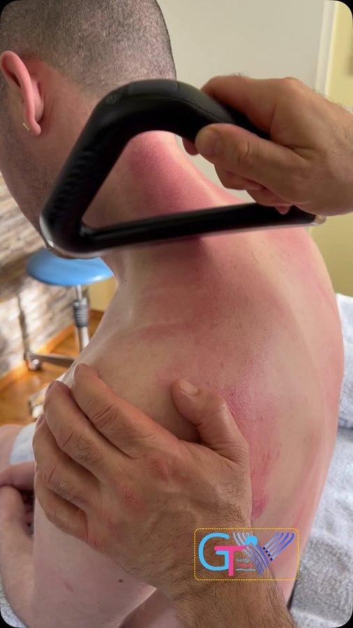 Instagram post by @georgi.therapy for Achedaway. Caption reads: ✨ Meet the @Achedaway Scraper: The Game-Changer in....