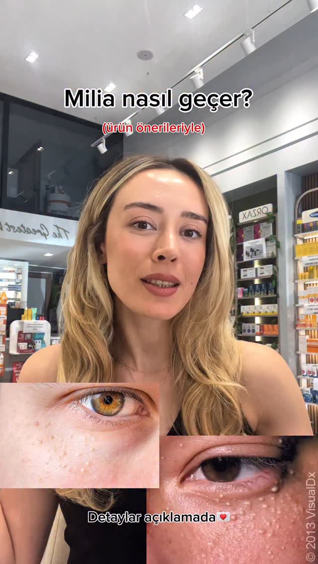 Instagram post by @eczaysesarac for Sephora. Caption reads: 👁 Milialar Neden Olur? Nasıl Geçer?

Milialar;....