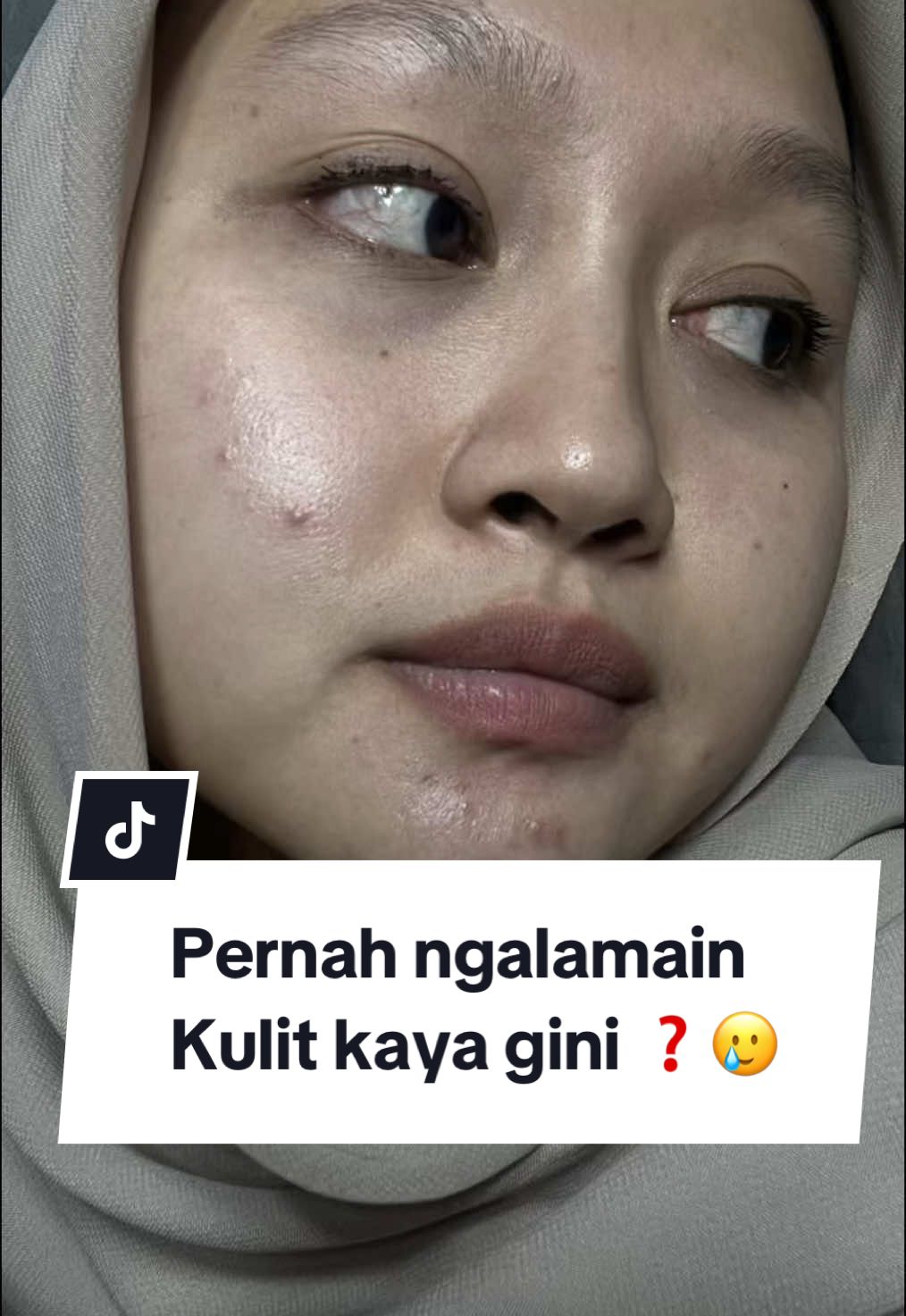 TikTok post by @flwlessvit for Acneno Indonesia. Caption reads: [...] lagi semenjak ketemu anceno 🙏🏻🥰 @Acneno....