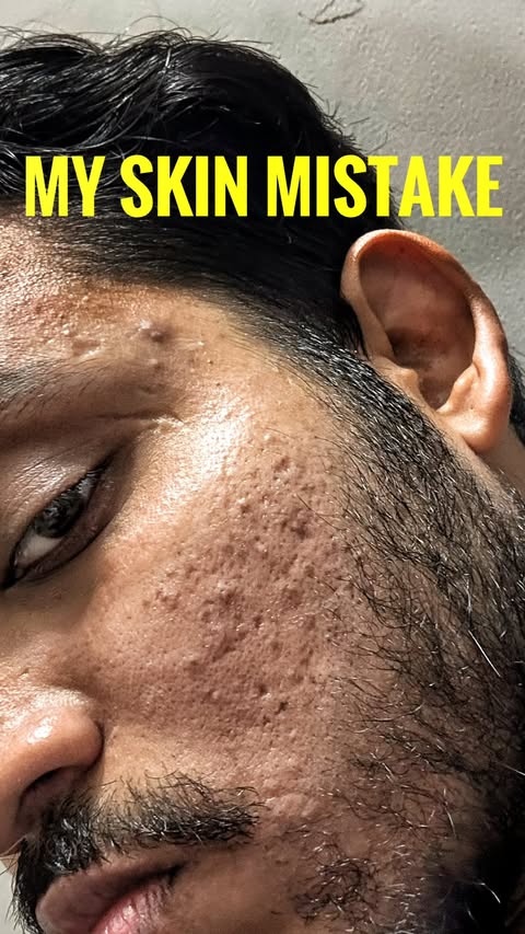 Instagram post by @mr_mannvaishnav for Dermatouch. Caption reads: [...] just needed the right one . Been using....
